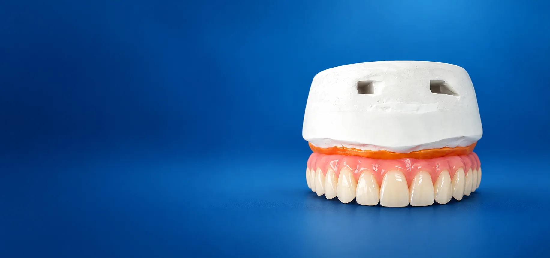 Prótese dentária sobre fundo azul da Sorrisus Joinville