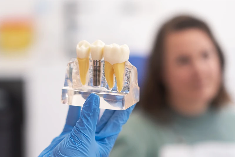 Implante ou dentadura: entenda as diferenças antes de escolher - imagem complementar