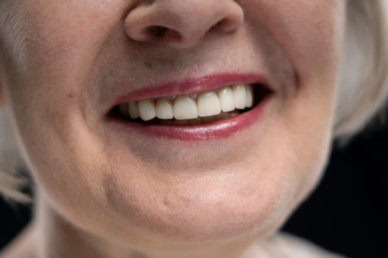 Imagem sobre implantes: Como funciona o implante dentário: etapas da avaliação ao acompanhamento