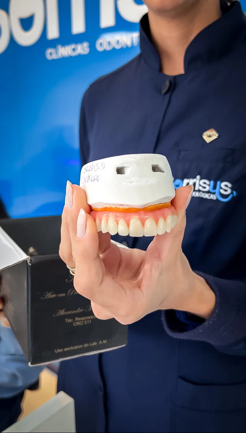 Imagem sobre implantes: Implante e prótese: qual é a diferença?